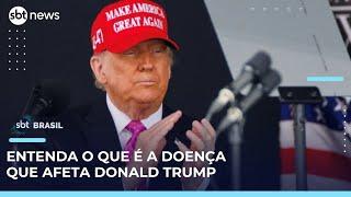 Insuficiência venosa crônica: médico explica o tratamento da doença de Donald Trump | #SBTBrasil 