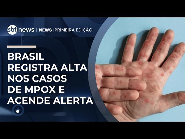 Brasil registra alta nos casos de Mpox e acende alerta em autoridades | #NewsPrimeiraEdição