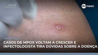 Brasil registra novos casos de Mpox em 2026 e acende alerta na saúde pública | #NewsSábado