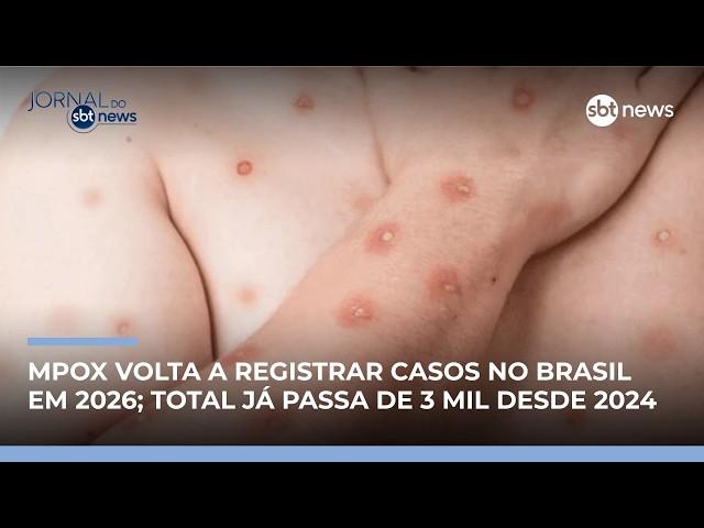 Brasil registra 46 casos de mpox em 2026 | #JornaldoSBTNews