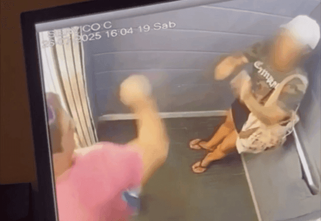 Mulher agredida com 61 socos passa por cirurgia de reconstrução facial 