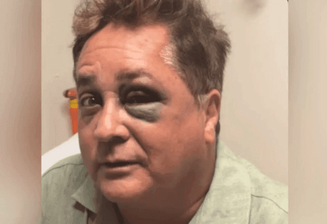 Leonardo sofre queda no Pantanal e esposa atualiza estado de saúde do cantor