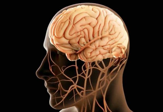 Cérebro protegido: como a cirurgia dos vasos previne derrame e salva vidas
