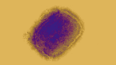 Prefeitura de Porto Alegre confirma primeiro caso de Mpox em 2026