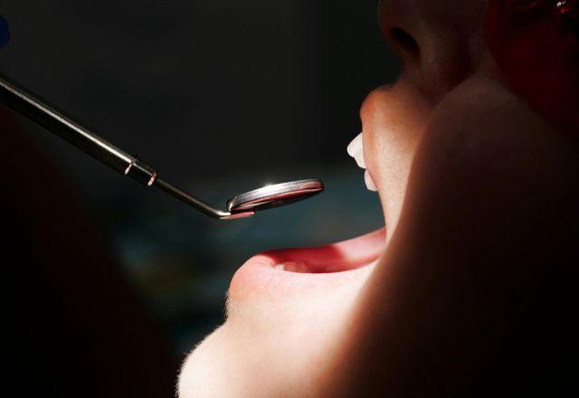 Saúde bucal: o que os dentes revelam sobre o corpo?