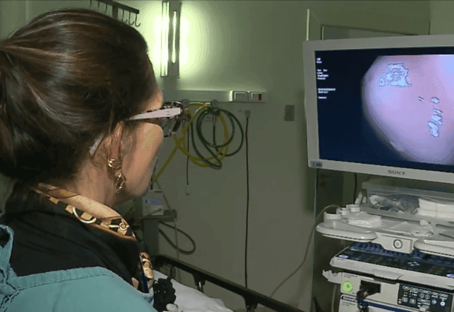 Câncer de intestino deve ter 145 novos casos por dia no Brasil em 2026