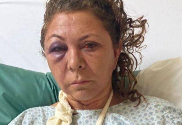 Recepcionista é agredida por hóspede dentro de hotel em Curitiba